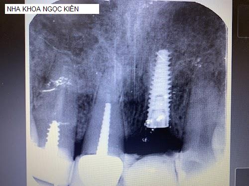 Yến Sào Kiên Giang - Gợi ý 10 Nha Khoa tốt nhất khu vực Huyện Tân Hiệp